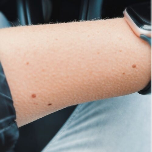 Kippenvel als stille compas